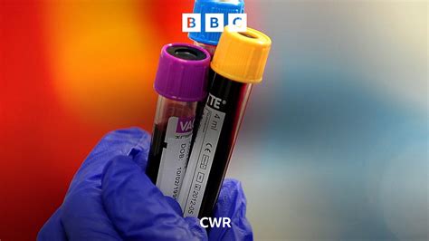 blood test drop in coventry|coventry blood test form.